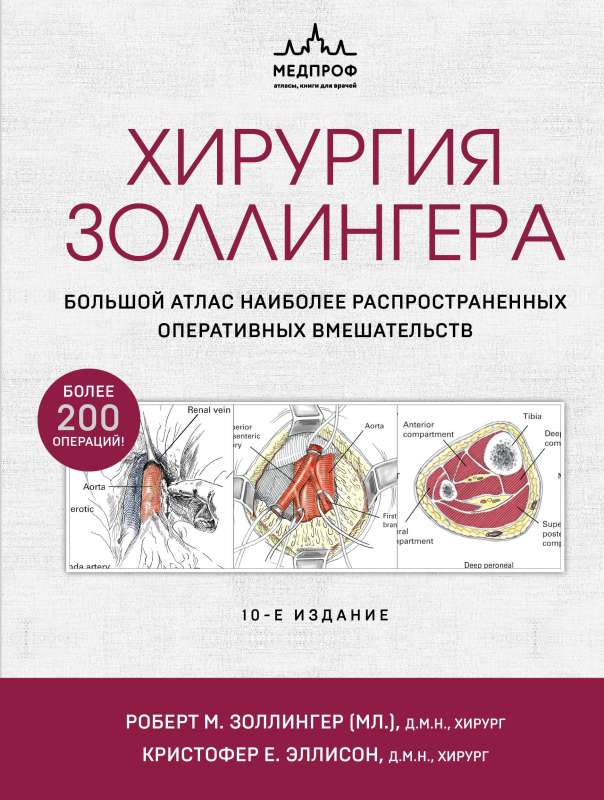 Хирургия Золлингера. Большой атлас наиболее распространенных оперативных вмешательств