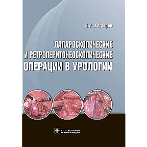 Лапароскопические и ретроперитонеоскопические операции в урологии