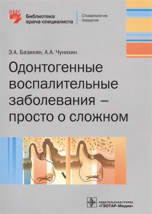 Одонтогенные воспалительные заболевания-просто о сложном