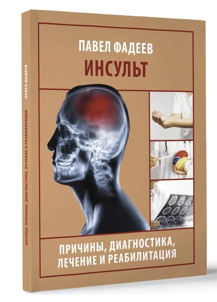 Инсульт. Причины, диагностика, лечение и реабилитация