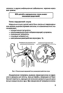 Дети с нарушениями слуха в условиях инклюзии